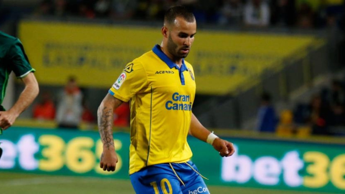 Las Palmas tiene dudas sobre el regreso de Jesé / UDLaspalmas.net