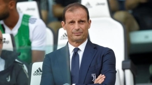Allegri tiene decidido cual será la primera baja de la Juventus / Foxsports.com