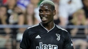 Pogba, ¿roto hasta 2023? / Antena2.com